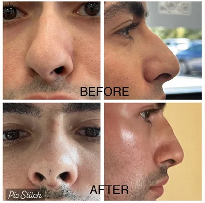 Client Transformation