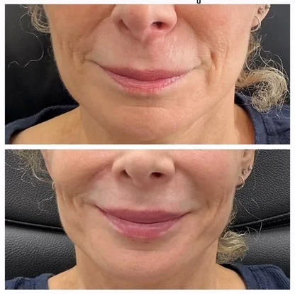 Client Transformation