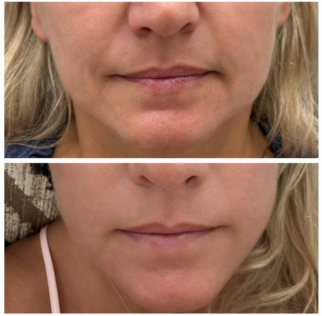 Client Transformation